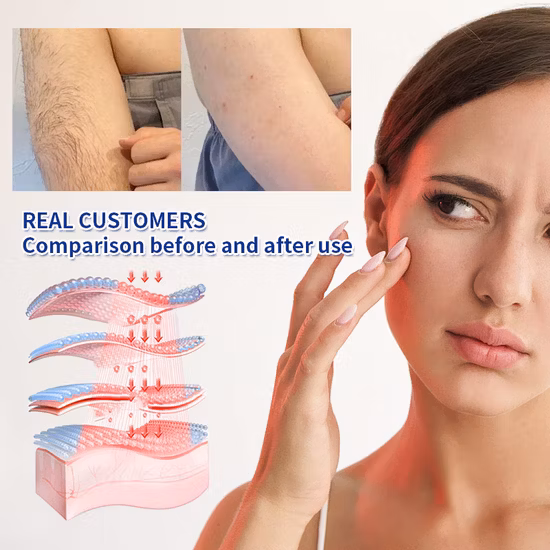 Ice Cool High Quality Beauty Equipment Painless Hair Removal IPL Laser